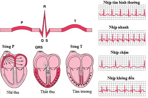 nguyen-nhan-dan-den-can-benh-tim-dap-cham-1